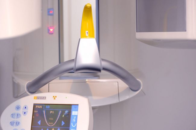 3D Röntgengerät Digitales Röntgen