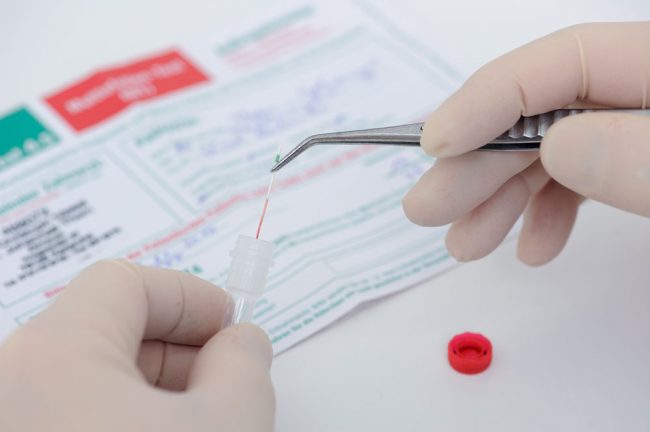 Paradontitis Bakterienbestimmung Paradontitis Bakterienbestimmung