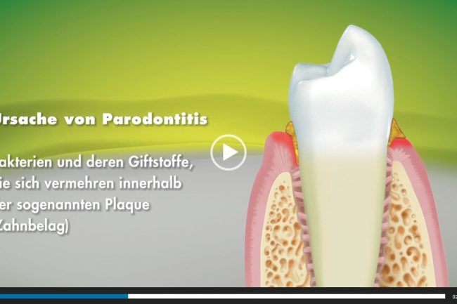 Regenerative Parodontologie