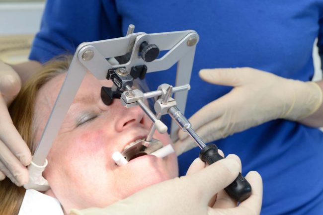 Gesichtsbogen Funktionsanalyse Kieferrelationsbestimmung